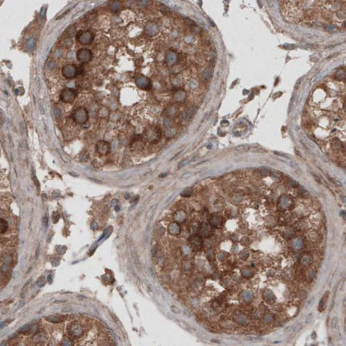Immunohistochemistry (Formalin/PFA-fixed paraffin-embedded sections) - Anti-VPS26 antibody [CL2287] - C-terminal (AB211530)