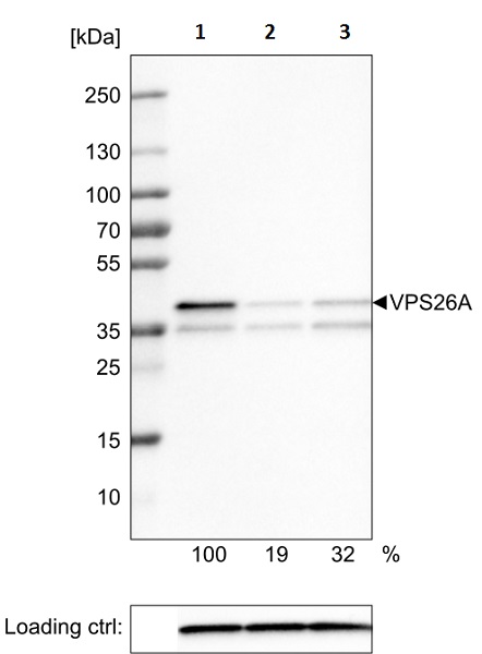 Western blot - Anti-VPS26 antibody [CL2287] - C-terminal (AB211530)