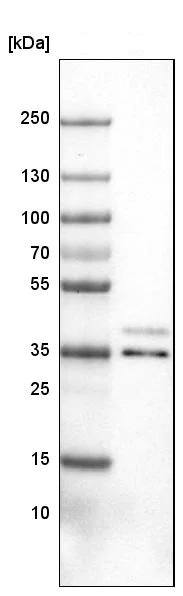 Western blot - Anti-VPS26 antibody [CL2287] - C-terminal (AB211530)