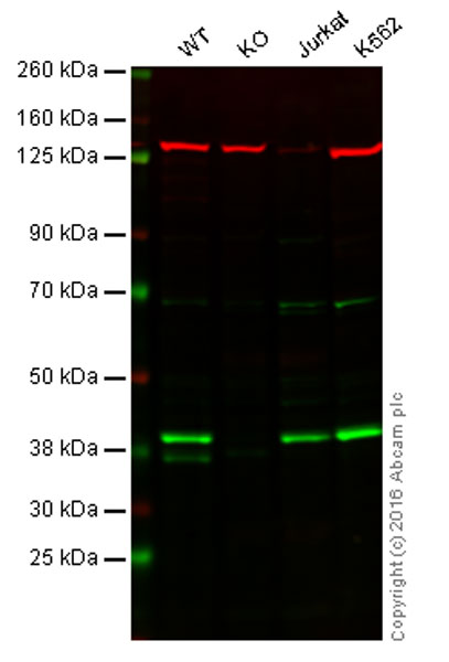 Western blot - Anti-VPS26 antibody [EPR13455(B)] - N-terminal (AB180172)