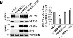 Western blot - Anti-VPS26 antibody [EPR13456] (AB181352)