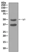 Immunoprecipitation - Anti-VPS26 antibody [EPR13456] - BSA and Azide free (AB250480)
