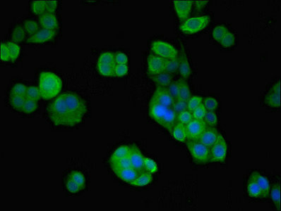 Immunocytochemistry/ Immunofluorescence - Anti-VPS26B antibody (AB236966), expandable thumbnail