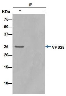 Immunoprecipitation - Anti-VPS28 antibody [EPR9880] (AB154793), expandable thumbnail