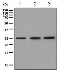 Western blot - Anti-VPS28 antibody [EPR9880] (ab154793), expandable thumbnail
