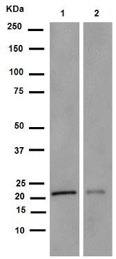 Western blot - Anti-VPS28 antibody [EPR9880] (AB154793), expandable thumbnail