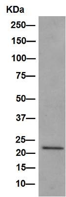 Western blot - Anti-VPS28 antibody [EPR9880] (AB154793), expandable thumbnail