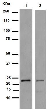 Western blot - Anti-VPS28 antibody [EPR9880] (AB154793), expandable thumbnail