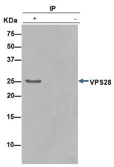 Immunoprecipitation - Anti-VPS28 antibody [EPR9880] - BSA and Azide free (AB249102)