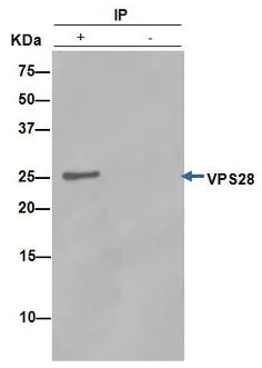 Immunoprecipitation - Anti-VPS28 antibody [EPR9880] - BSA and Azide free (AB249102)