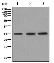 Western blot - Anti-VPS28 antibody [EPR9880] - BSA and Azide free (AB249102)