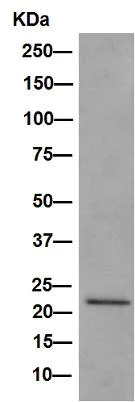 Western blot - Anti-VPS28 antibody [EPR9880] - BSA and Azide free (AB249102)