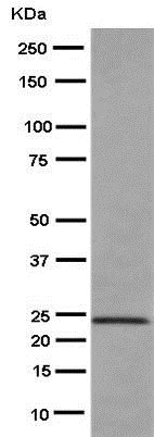 Western blot - Anti-VPS28 antibody [EPR9880] - BSA and Azide free (AB249102)