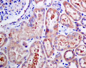 Immunohistochemistry (Formalin/PFA-fixed paraffin-embedded sections) - Anti-VPS28 antibody [EPR9881(B)] (AB167172)