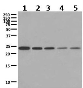 Western blot - Anti-VPS28 antibody [EPR9881(B)] - BSA and Azide free (AB249413), expandable thumbnail