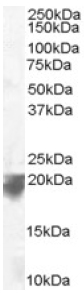 Western blot - Anti-VPS29 antibody (AB10160)