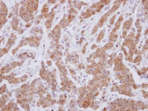 Immunohistochemistry (Formalin/PFA-fixed paraffin-embedded sections) - Anti-VPS29 antibody (AB228916)
