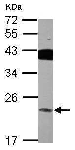 Western blot - Anti-VPS29 antibody (AB228916)