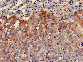 Immunohistochemistry (Formalin/PFA-fixed paraffin-embedded sections) - Anti-VPS29 antibody (AB236796)