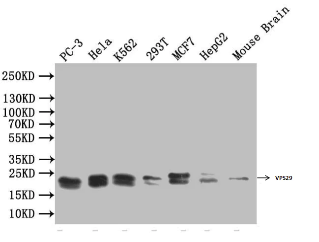 Western blot - Anti-VPS29 antibody (AB236796)