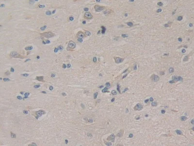 Immunohistochemistry (Formalin/PFA-fixed paraffin-embedded sections) - Anti-VPS34 antibody (AB233437)