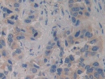 Immunohistochemistry (Formalin/PFA-fixed paraffin-embedded sections) - Anti-VPS34 antibody (AB233437)