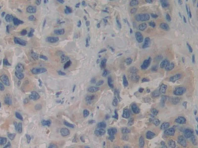 Immunohistochemistry (Formalin/PFA-fixed paraffin-embedded sections) - Anti-VPS34 antibody (AB233437)