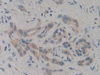 Immunohistochemistry (Formalin/PFA-fixed paraffin-embedded sections) - Anti-VPS34 antibody (AB233437)
