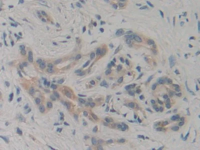 Immunohistochemistry (Formalin/PFA-fixed paraffin-embedded sections) - Anti-VPS34 antibody (AB233437)