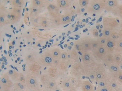 Immunohistochemistry (Formalin/PFA-fixed paraffin-embedded sections) - Anti-VPS34 antibody (AB233437)