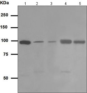 Western blot - Anti-VPS34 antibody [EPR5301] (AB124905)