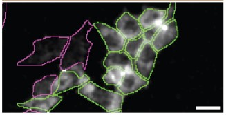 Immunocytochemistry/ Immunofluorescence - Anti-VPS35 antibody [2D3] (AB57632)