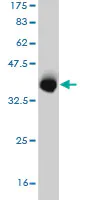 Western blot - Anti-VPS35 antibody [2D3] (AB57632)