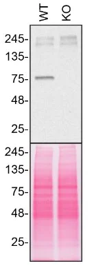Western blot - Anti-VPS35 antibody [2D3] (AB57632)