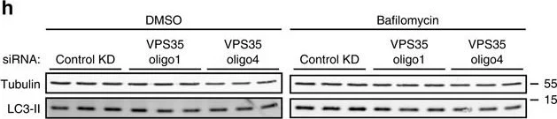 Western blot - Anti-VPS35 antibody [2D3] (AB57632)