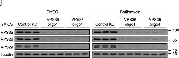 Western blot - Anti-VPS35 antibody [2D3] (AB57632)