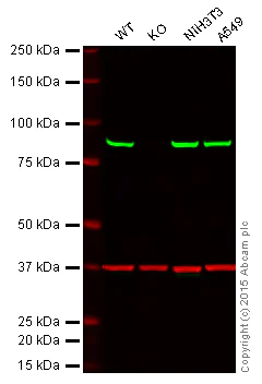 Western blot - Anti-VPS35 antibody [2D3] (AB57632)