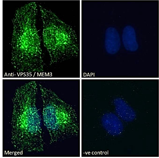 Immunocytochemistry/ Immunofluorescence - Anti-VPS35 antibody (AB10099), expandable thumbnail