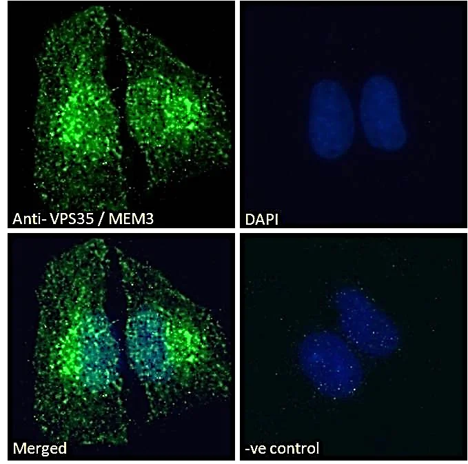 Immunocytochemistry/ Immunofluorescence - Anti-VPS35 antibody (AB10099)