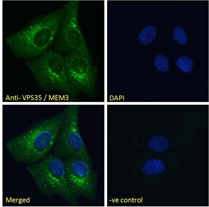 Immunocytochemistry/ Immunofluorescence - Anti-VPS35 antibody (AB10099)