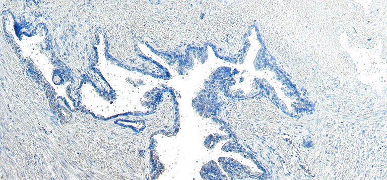 Immunohistochemistry (Formalin/PFA-fixed paraffin-embedded sections) - Anti-VPS35 antibody (AB10099)