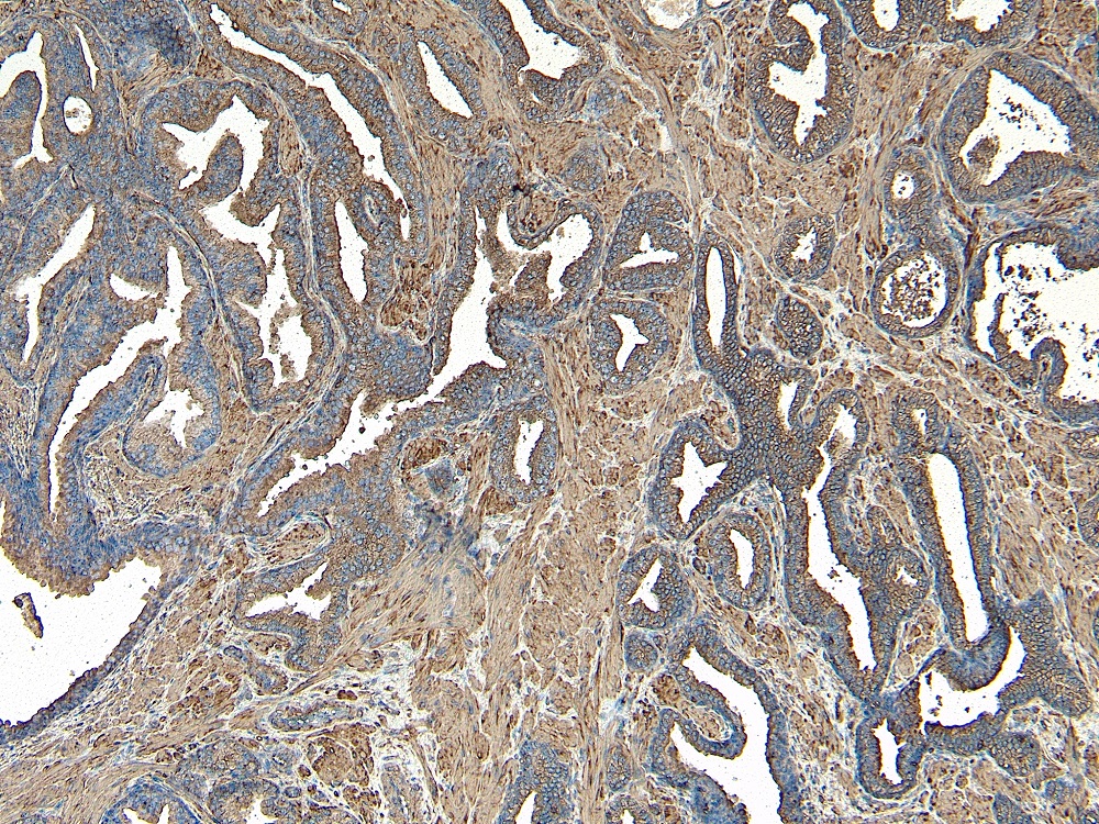 Immunohistochemistry (Formalin/PFA-fixed paraffin-embedded sections) - Anti-VPS35 antibody (ab10099), expandable thumbnail