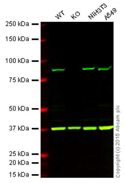 Western blot - Anti-VPS35 antibody (AB10099), expandable thumbnail