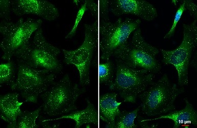 Immunocytochemistry/ Immunofluorescence - Anti-VPS35 antibody (AB97545)