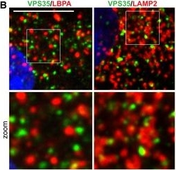 Immunofluorescence - Anti-VPS35 antibody (AB97545)