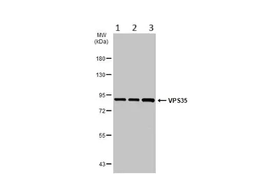 Western blot - Anti-VPS35 antibody (AB97545)