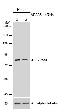 Western blot - Anti-VPS35 antibody (AB97545)