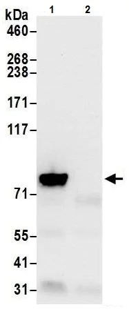 Immunoprecipitation - Anti-VPS35 antibody - C-terminal (AB226180)