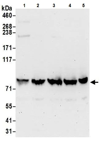 Western blot - Anti-VPS35 antibody - C-terminal (AB226180)
