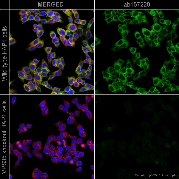 Immunocytochemistry/ Immunofluorescence - Anti-VPS35 antibody [EPR11501(B)] (AB157220), expandable thumbnail